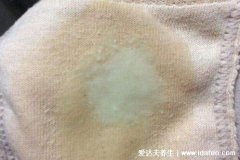 怎么判斷霉菌還是滴蟲，注意觀察內褲上的分泌物(圖片)