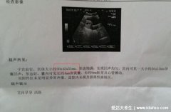 B超有兩點基本是男孩，教你看四維單子上男孩標志